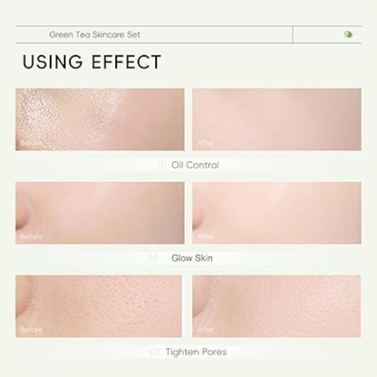 Cleanser,Face Serum, Face Cream, Eye Cream, Facial Mask And Mud Mask,Moisturizing Skincare Set